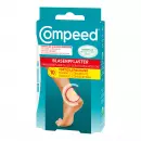 Compeed Blasenpflaster Medium, пластырь для мозолей