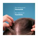 Лосьон Ducray Anaphase Creastim для временного выпадения волос - Лосьон Ducray Anaphase Creastim для временного выпадения волос